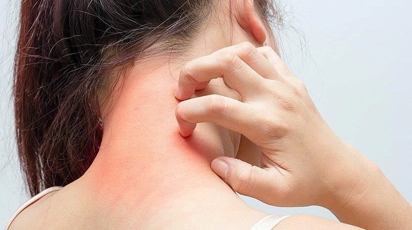 Зуд: постоянный зуд - один из самых заметных симптомов.