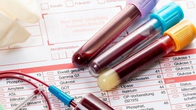 Анализы крови могут дать дополнительные сведения, особенно при выявлении аутоиммунных маркеров и исключении инфекционной этиологии. Кроме того, нейрофизиологические исследования, включая вызванные потенциалы, играют важную роль в оценке функционального влияния заболевания на нервную проводимость и сигнализацию.