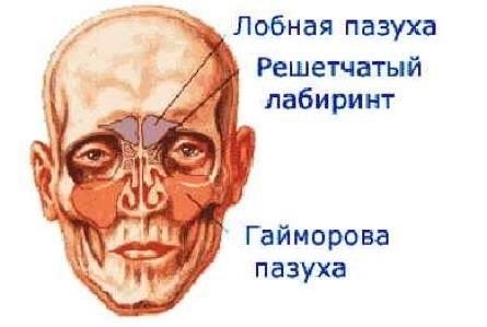Проблемы с околоносовыми пазухами, приводящие к таким симптомам, как заложенность, давление и боль.